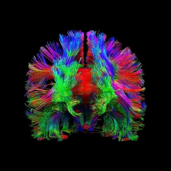 Image of your own brain