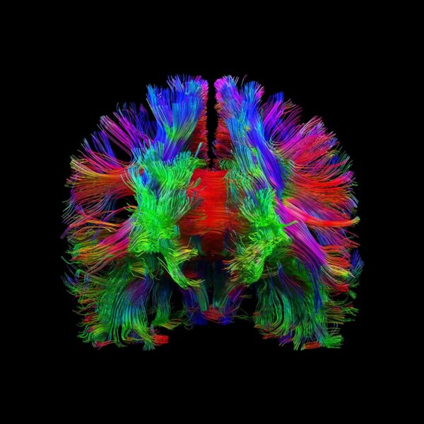 Frontal fibers in colour on black