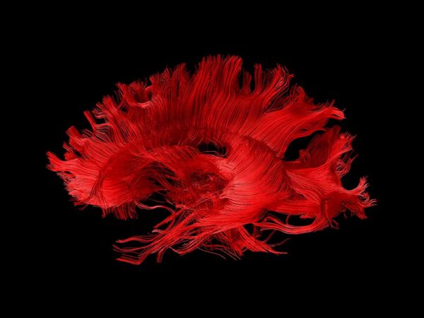 Lateral fibers in red on black
