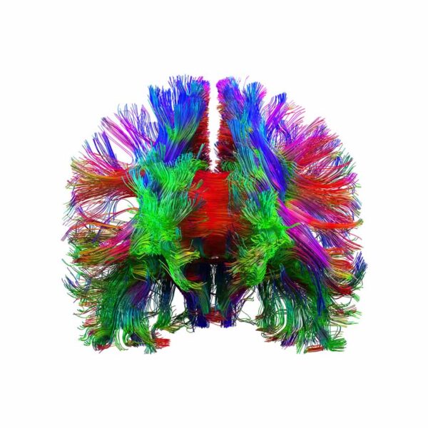Frontal fibers in colour on white